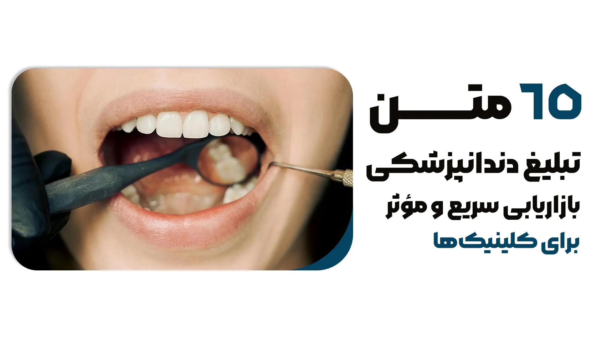65 نمونه متن پیامکی دندانپزشکی+ بازاریابی سریع و مؤثر برای کلینیک‌ها